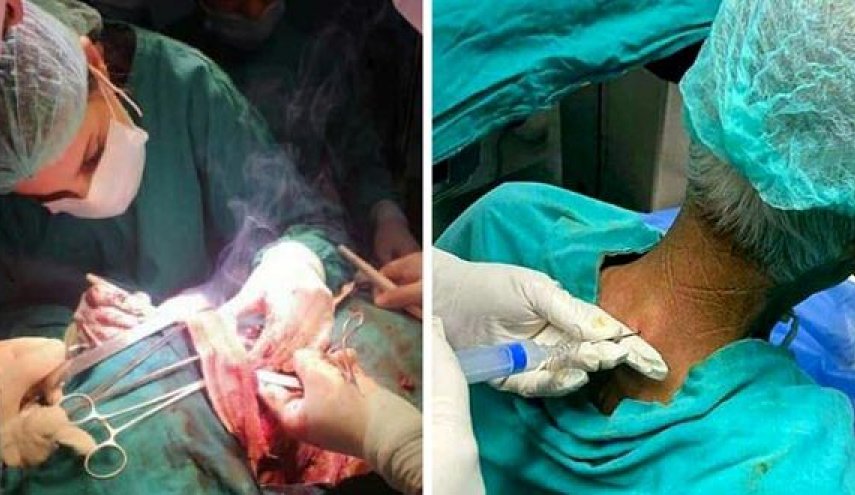 عملية جراحية هي الاولى سوريا والـ11 عالمياً