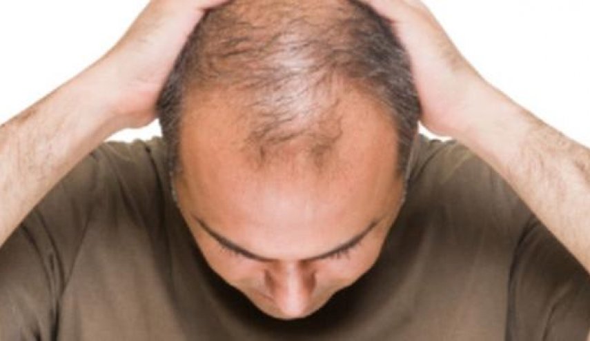 أسباب تساقط الشعر واحسن الطرق لعلاجها