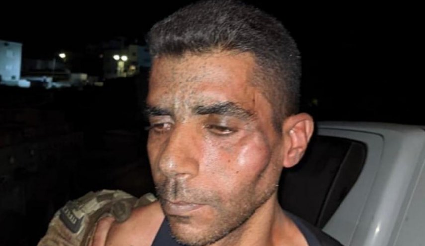 هكذا عنف واعتقل زكريا الزبيدى على يد وحشية الاحتلال