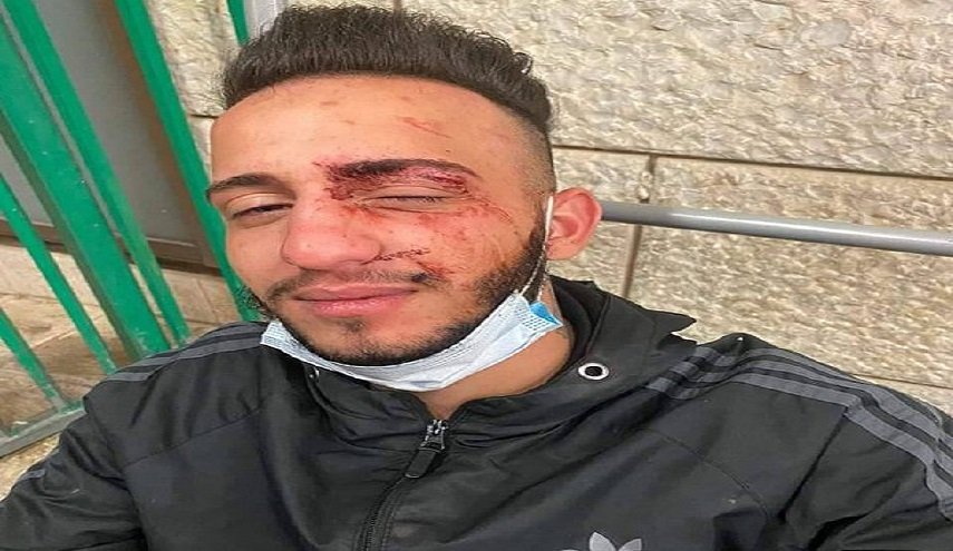 مستوطنون يعتدون على فلسطيني في القدس المحتلة
