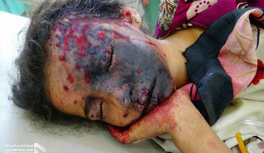 مخلفات والغام تحالف العدوان لا تزال تفتك بالشعب اليمني