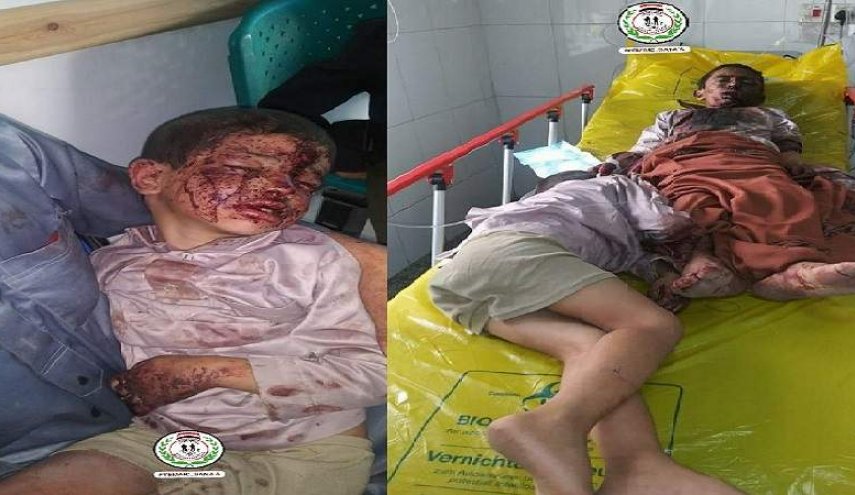 إصابة طفلين بانفجار قنبلة عنقودية من مخلفات العدوان في صعدة
