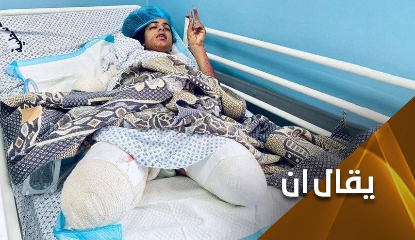 امريكا 'راعية حقوق الانسان'.. تندد باصابة حلفائها وتتعامى عن تقطع اشلاء الآخرين!