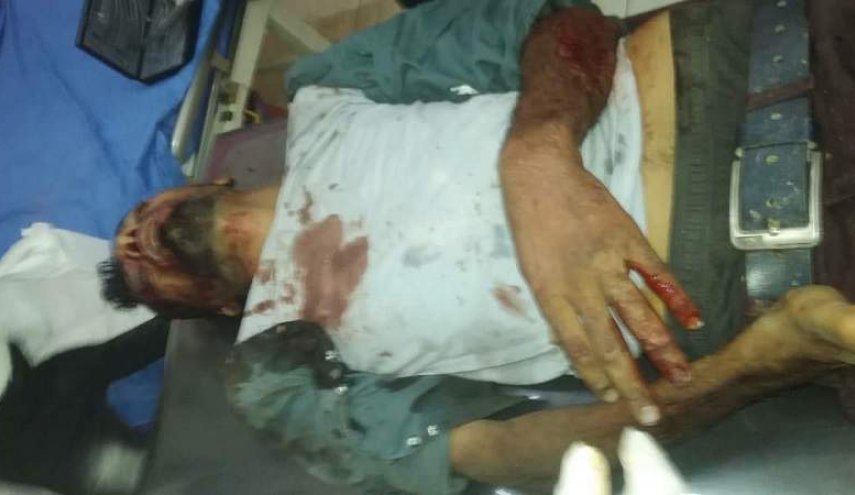 اليمن.. إصابات جراء انفجار أجسام من مخلفات العدوان