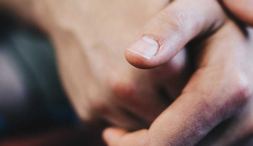 تعرف على علامات على الأظافر تكشف إصابتك بمرض السكري
