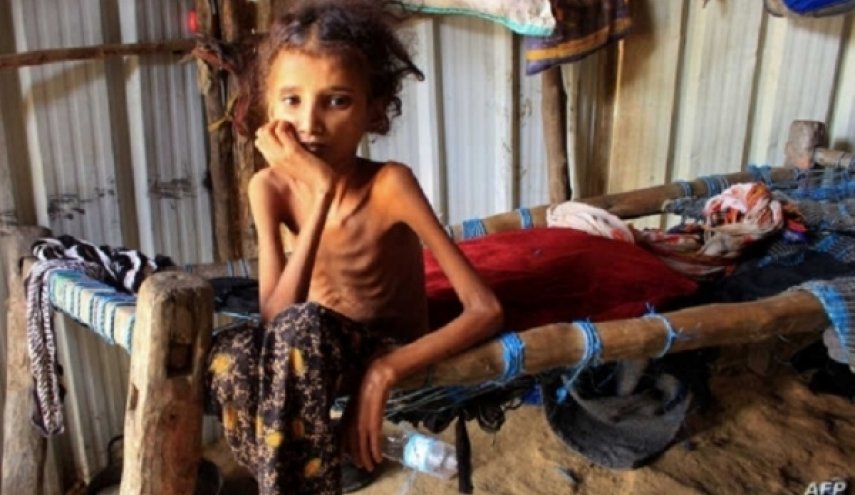الأمم المتحدة: معدلات الجوع ارتفعت 10 أضعاف في اليمن