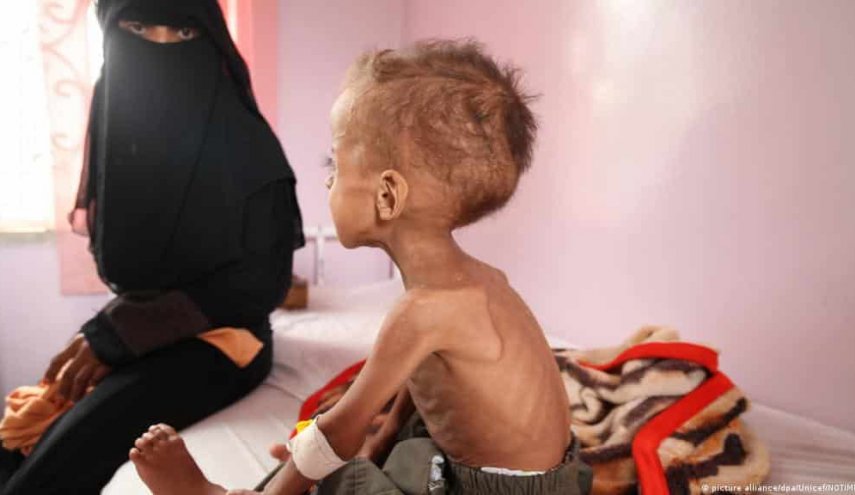 الشيوخ الأمريكي يستعد للتصويت على وقف الدعم العسكري السعودي باليمن