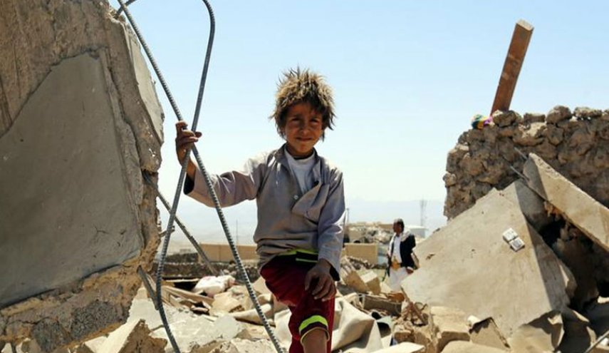  صورة مؤلمة لطفل تظهر جرائم حرب في اليمن

