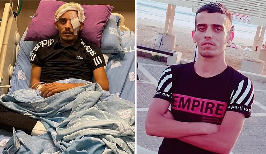 شاب مقدسي يستشهد متأثرا باصابته برصاص الاحتلال قبل نحو عامين