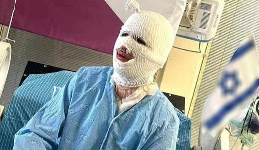 بالصورة.. جندي صهيوني 'متفحم' يثير رواد مواقع التواصل