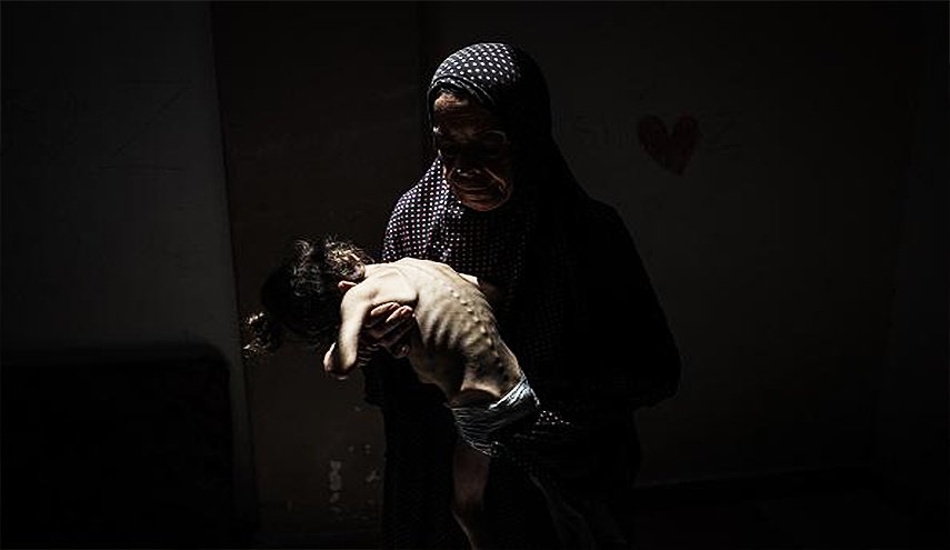 المجاعة تفتك بأطفال غزة والعالم مطالب برؤية الحقيقة
