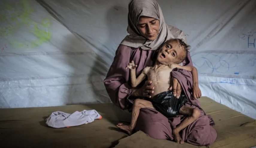 حصيلة ضحايا المجاعة في غزة ترتفع إلى 332 شهيدًا
