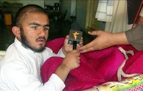 کودک ۷ساله با ریش، سبیل و۲۴ انگشت + عکس