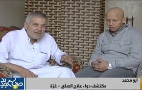 ابو محمد مکتشف دواء لعلاج الصلع