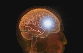 علاجات جديدة لاصابات الدماغ