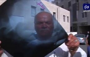 جا ماندن تلفن همراه در شکم زن اردنی، واقعیت یا فیلم هندی ؟!