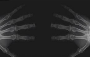 شاهد ماذا يحصل عند طقطقة أصابعك!