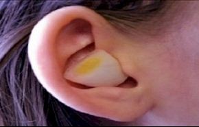 هذا ما يحصل عند وضع البصل في أذنيك لليلة كاملة!