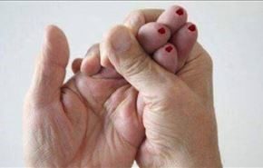 أكثر طريقة فعالة لإنقاذ المصابين بالجلطات الدماغية!