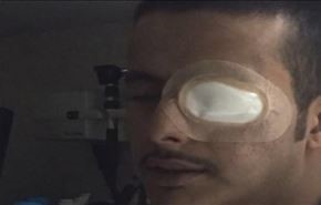 بالصورة.. انصارالله يفقأون عين آل سعود