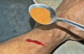 وصفة طبيعية.. كيف توقفون النزيف في 15 ثانية فقط ؟