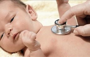 مرض الكساح عند الاطفال