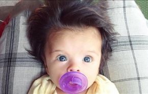 صور/ شعرت بحرقة خلال الحمل والنتيجة تهمّ كل أم!