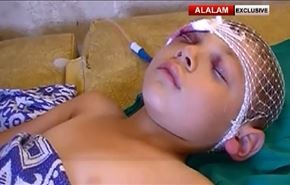 شاهد: قنص اطفال الفوعة لاتطفئ غليل جيش الفتح..ولديه المزيد!