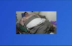 أمل جديد لرجل يبلغ وزنه 500 كيلوغرام