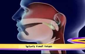 حموضة المعدة واسبابها