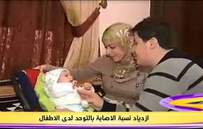 ازدياد نسبة الاصابة بالتوحد لدى المواليد الجدد