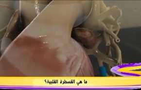 ما  هي القسطرة القلبية؟