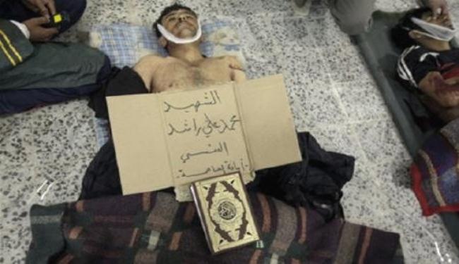 استشهاد 12 شخصا وجرح أكثر من 130 في صنعاء