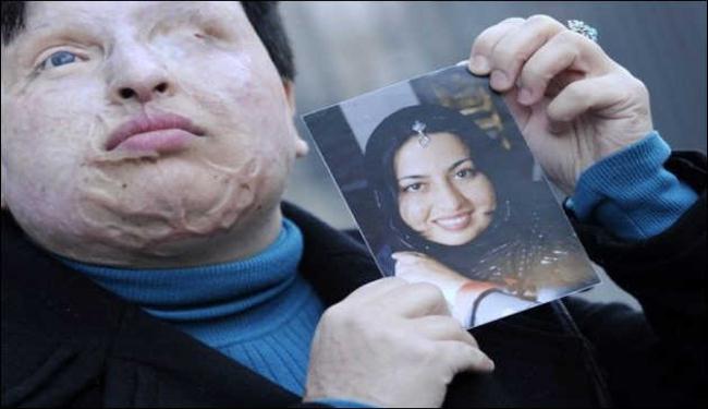 آمنة تعفو عن الشاب الذي شوه وجهها بالحامض