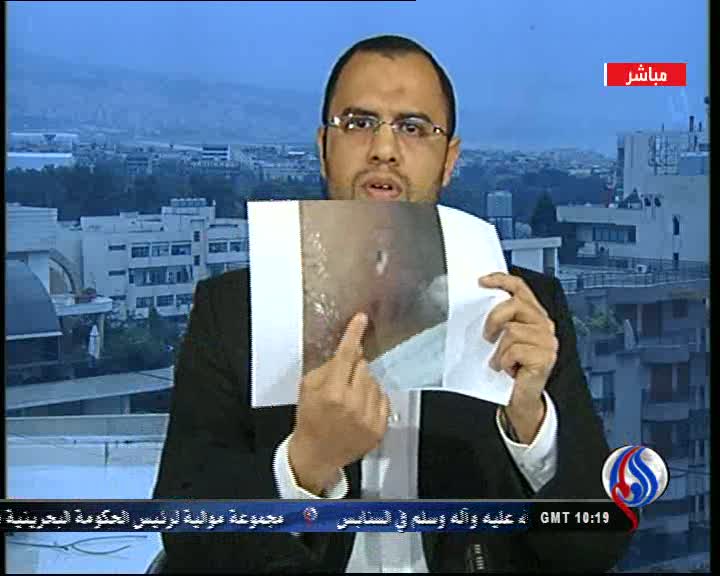 سوزاندن مخالفان در بحرین