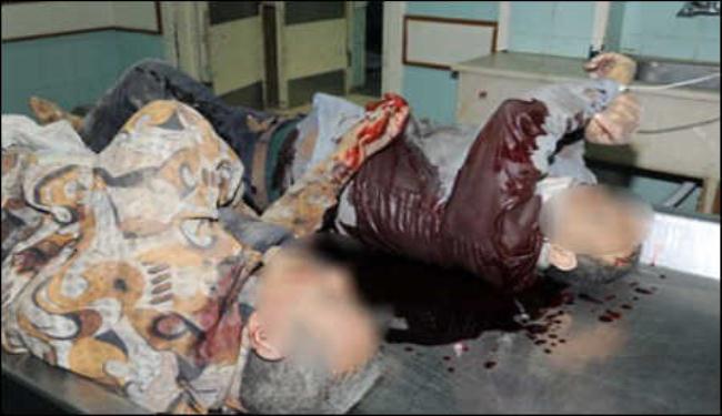 اصابة 3 بانفجار عبوة ناسفة زرعها مسلحون بحلب  