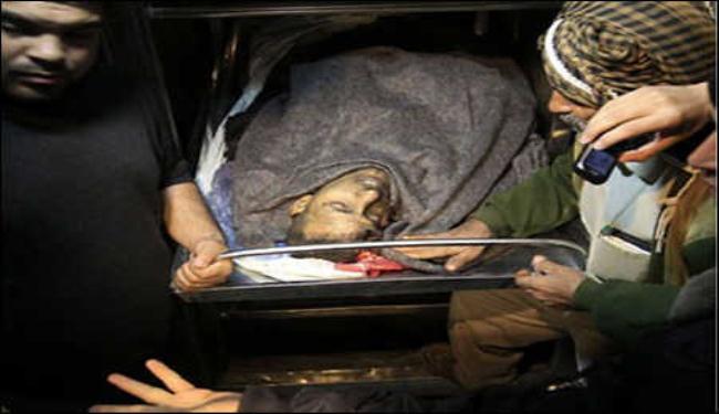 استشهاد فلسطيني متاثرا بجروح خلال عدوان للاحتلال بغزة