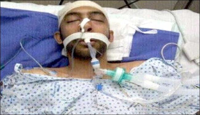انتكاس حالة البحريني علي الموالي المصاب بطلق في رأسه