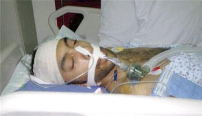 محتج بحريني مصاب بأسلحة النظام في غيبوبة لأكثر من أسبوع