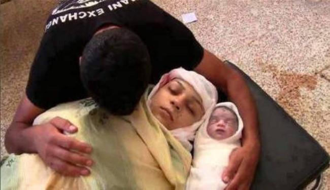 31 شهيداً و450 جريحاً ضحايا العدوان الاسرائيلي على غزة