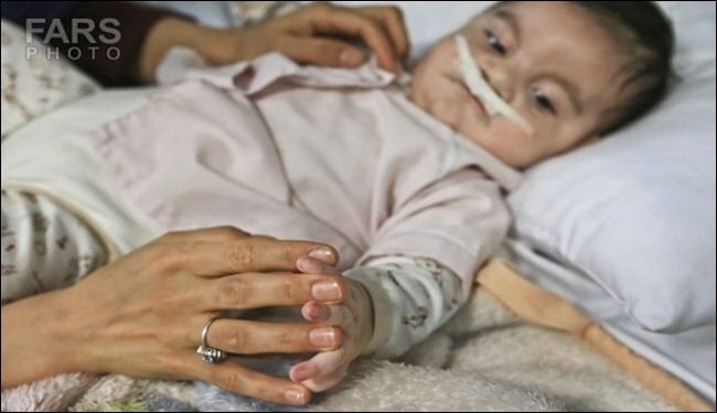 نذور الاطباء الإيرانيين تنقذ 36 مريضا من الفقراء