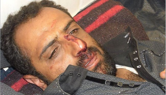 عناصر من جهاز الامن القومي تعتدي على حوثيين بصنعاء
