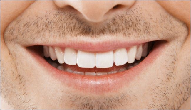 وصفة طبيعية تجعل الأسنان بيضاء كالثلج