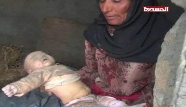 خودکشی خلبان سعودی پس از مشاهده تصاویر اجساد کودکان یمنی