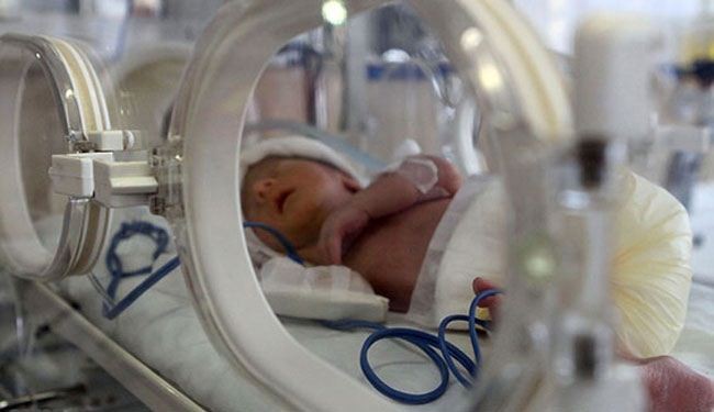 إيران..التشخیص العاجل لمرض خطیر لدی الأطفال الخدج