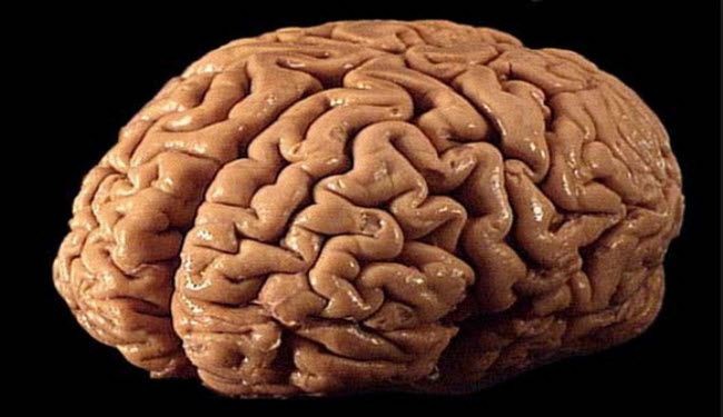 علماء يستخدمون موجات المخ الكهربية لمرضى الشلل
