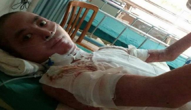 شاهد ماذا فعل طفلان لأبيهم الذي حرق جسده لإنقاذهما؟