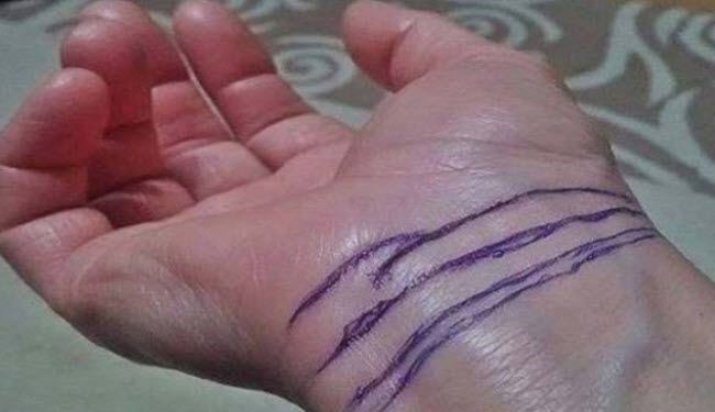 هل تعرف ماذا تعني هذه الخطوط على المعصم؟