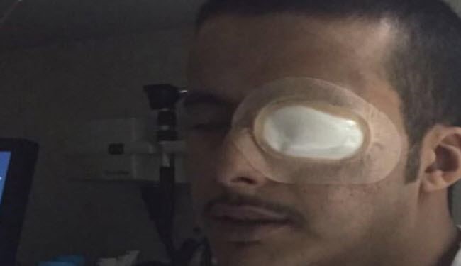 بالصورة.. انصارالله يفقأون عين آل سعود