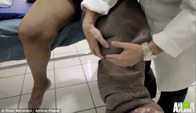 نیش این پشه شما را فیل می کند!